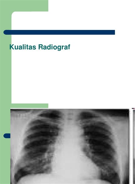 fokus11