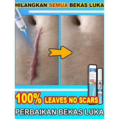 olx101
